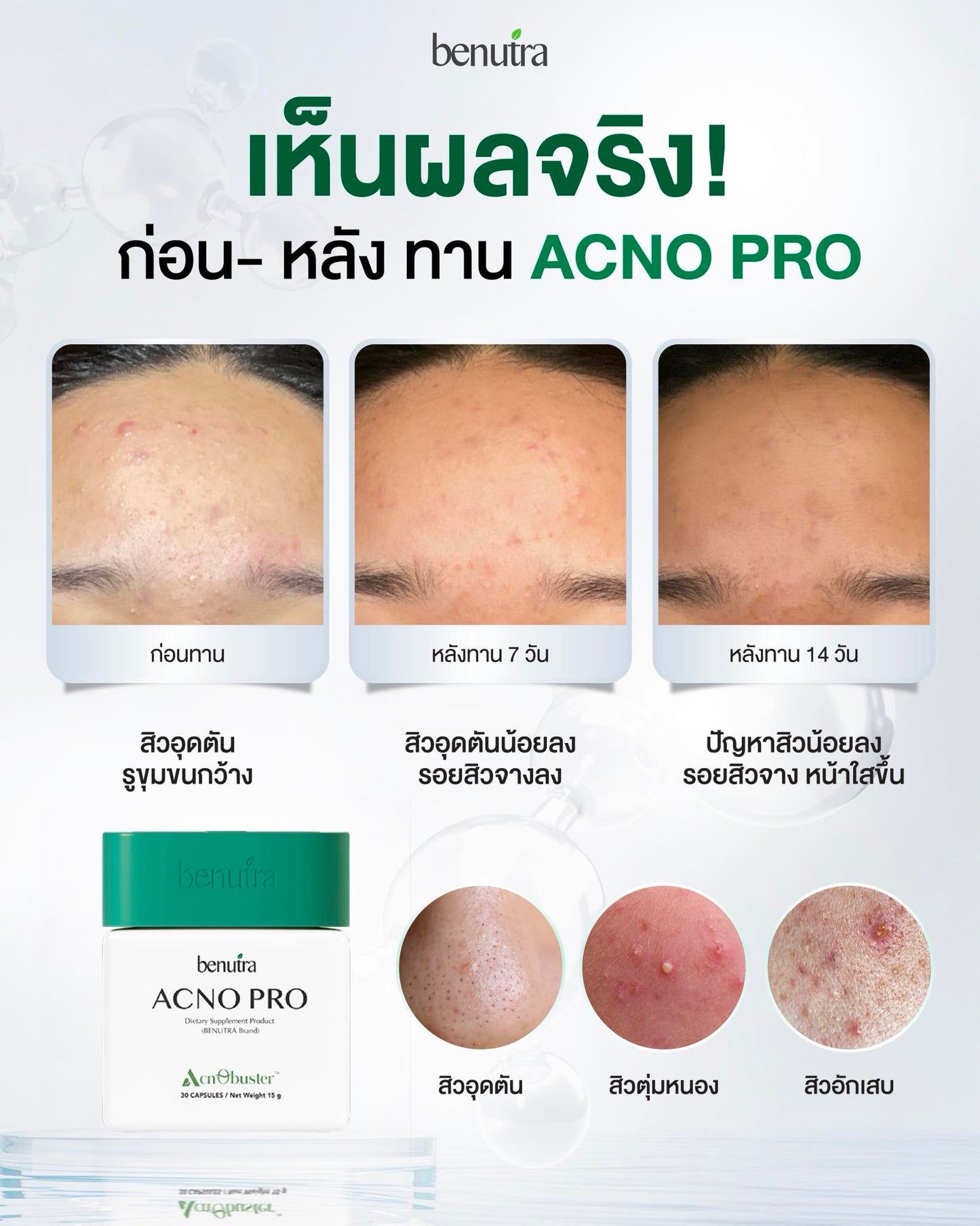BENUTRA TETRA SOD with Astaxanthin CoQ10 Antioxidant Power for Skin Health