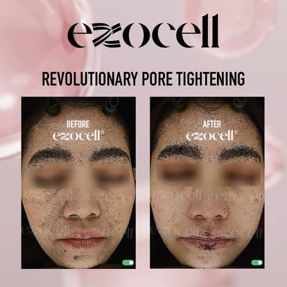 EXOCELL Exosome Rejuvenation Ampoule Stem Cell Power Bottle