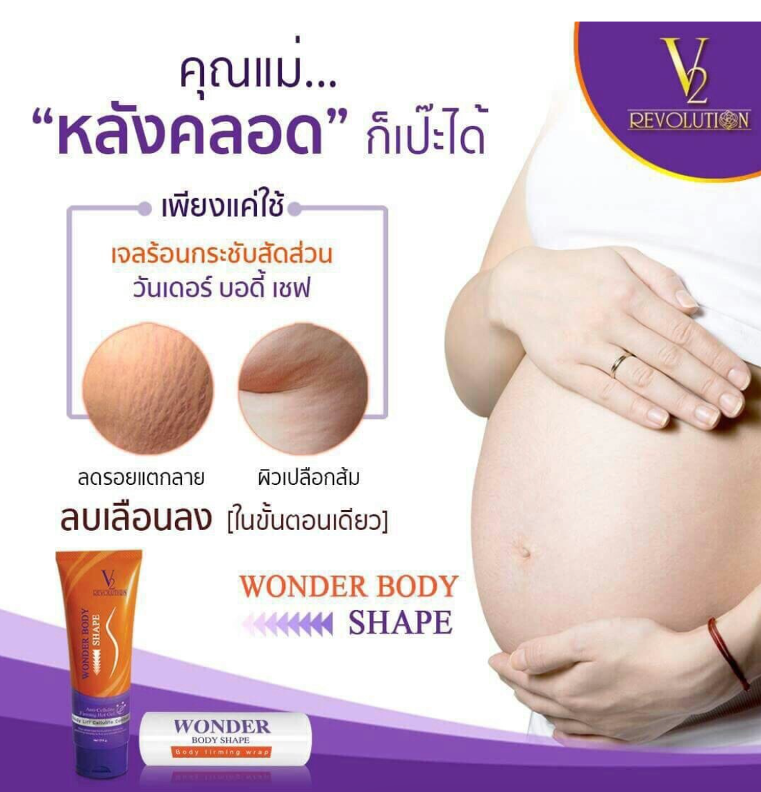 V2 Revolution Stretch Mark & Cellulite Solution