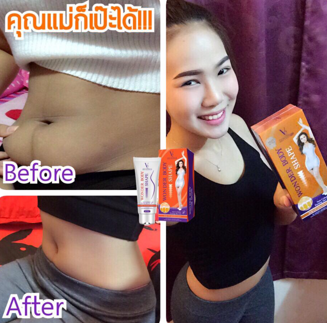 V2 Revolution Stretch Mark & Cellulite Solution