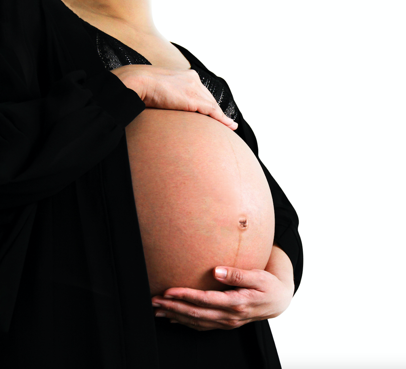 V2 Revolution Stretch Mark & Cellulite Solution