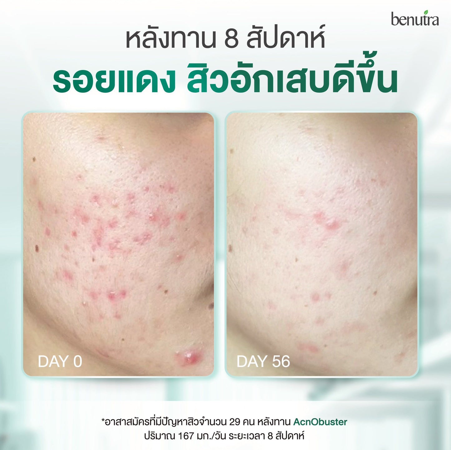 BENUTRA TETRA SOD with Astaxanthin CoQ10 Antioxidant Power for Skin Health