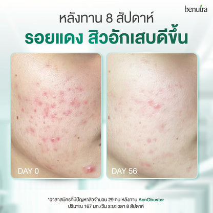 BENUTRA TETRA SOD with Astaxanthin CoQ10 Antioxidant Power for Skin Health