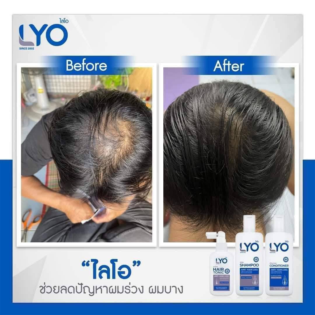 Lyo Shampoo Conditioner Hair Tonic Treatment Hair Strengthen & Regrowth