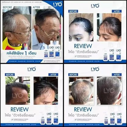 Lyo Shampoo Conditioner Hair Tonic Treatment Hair Strengthen & Regrowth