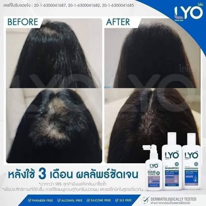 Lyo Shampoo Conditioner Hair Tonic Treatment Hair Strengthen & Regrowth