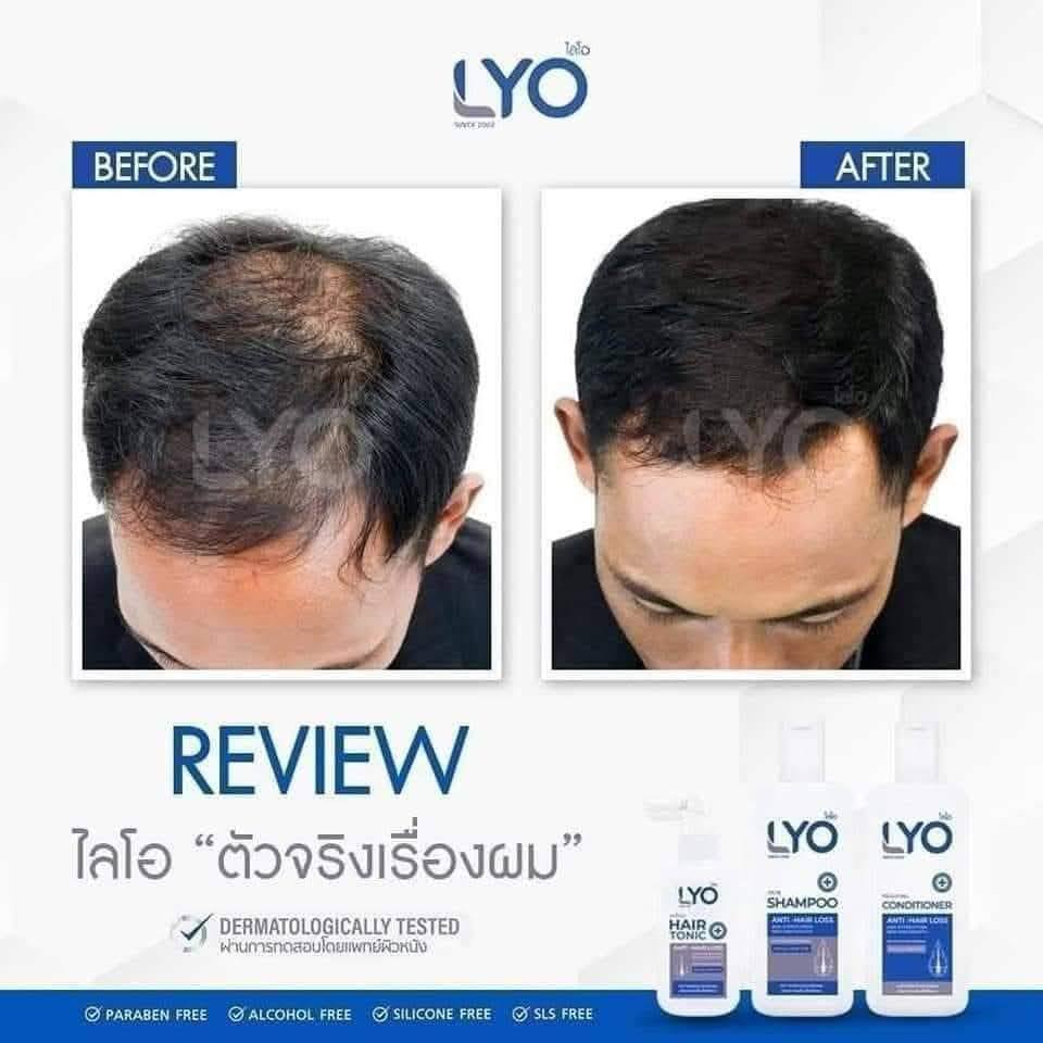 Lyo Shampoo Conditioner Hair Tonic Treatment Hair Strengthen & Regrowth