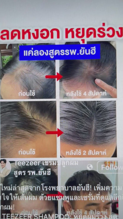 Yanhee Teezeer Anti Hair Fall Nourishes Hair Roots Control Serum 60 ml