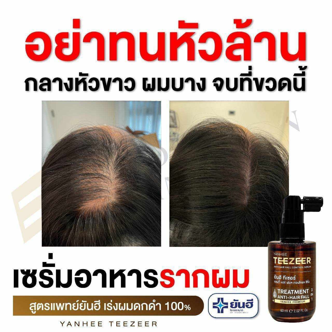 Yanhee Teezeer Anti Hair Fall Nourishes Hair Roots Control Serum 60 ml